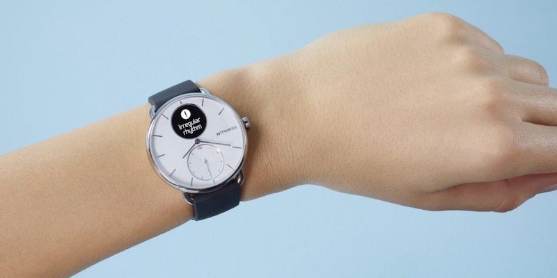 Withings ScanWatch wearable heart monitor